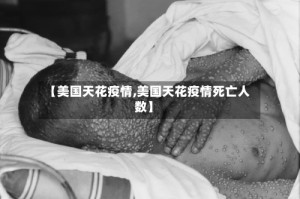 【美国天花疫情,美国天花疫情死亡人数】