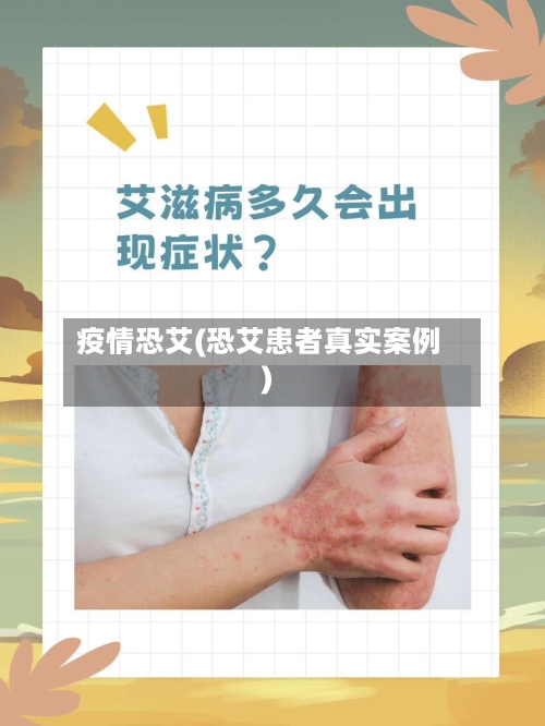 疫情恐艾(恐艾患者真实案例)-第1张图片