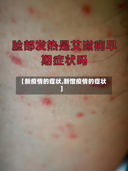 【新疫情的症状,新馆疫情的症状】-第2张图片