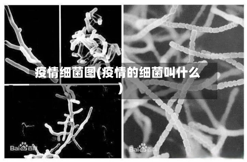 疫情细菌图(疫情的细菌叫什么)-第1张图片