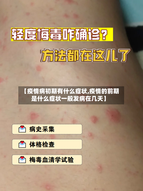 【疫情病初期有什么症状,疫情的前期是什么症状一般发病在几天】-第2张图片
