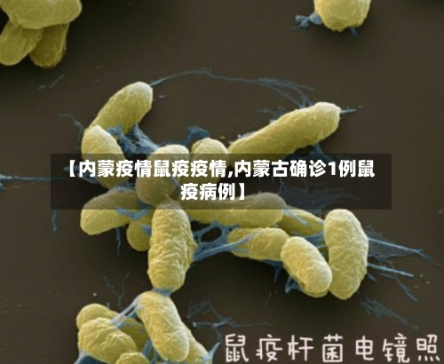【内蒙疫情鼠疫疫情,内蒙古确诊1例鼠疫病例】-第2张图片
