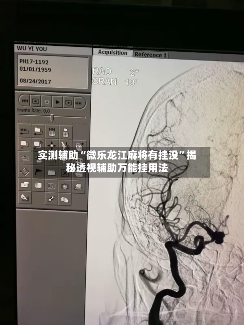 实测辅助“微乐龙江麻将有挂没”揭秘透视辅助万能挂用法-第2张图片